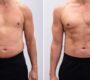 imageye___ _imgi_10_fat loss peptide stack before after 90x80